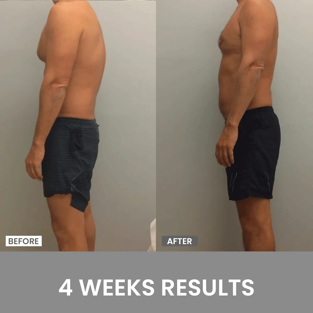 Posture Fixer – Straighten Up in a Jiffy! (Grab One, Get One Free!)
