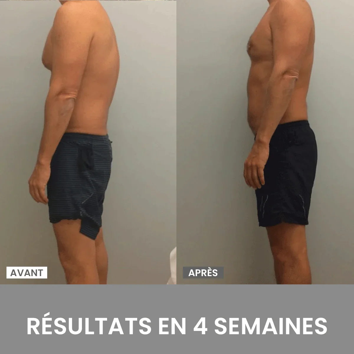 Posture Fixer – Stand Tall in a Jiffy! (Grab One, Get One Free!)