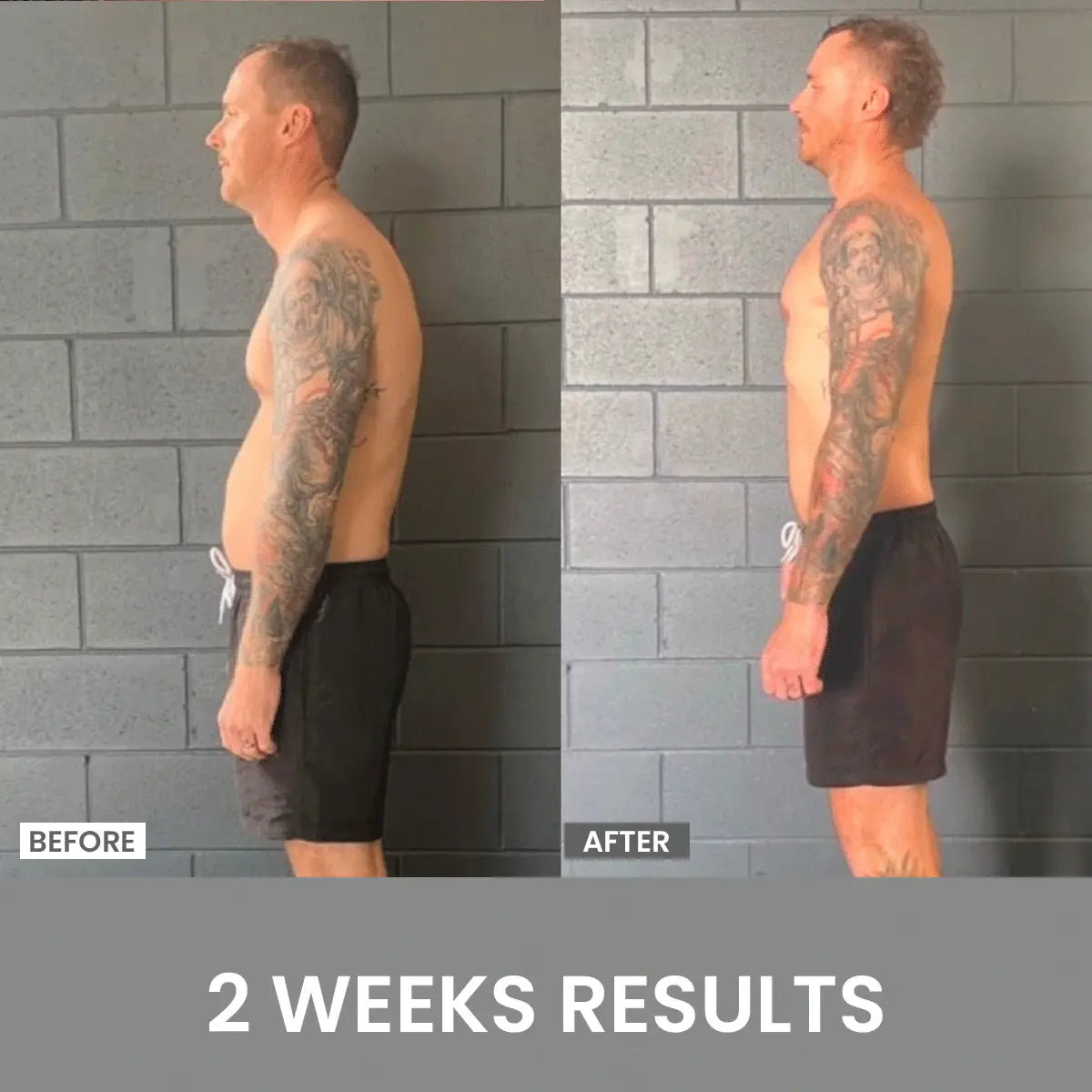 Posture Fixer – Straighten Up in a Jiffy! (Grab One, Get One Free!)