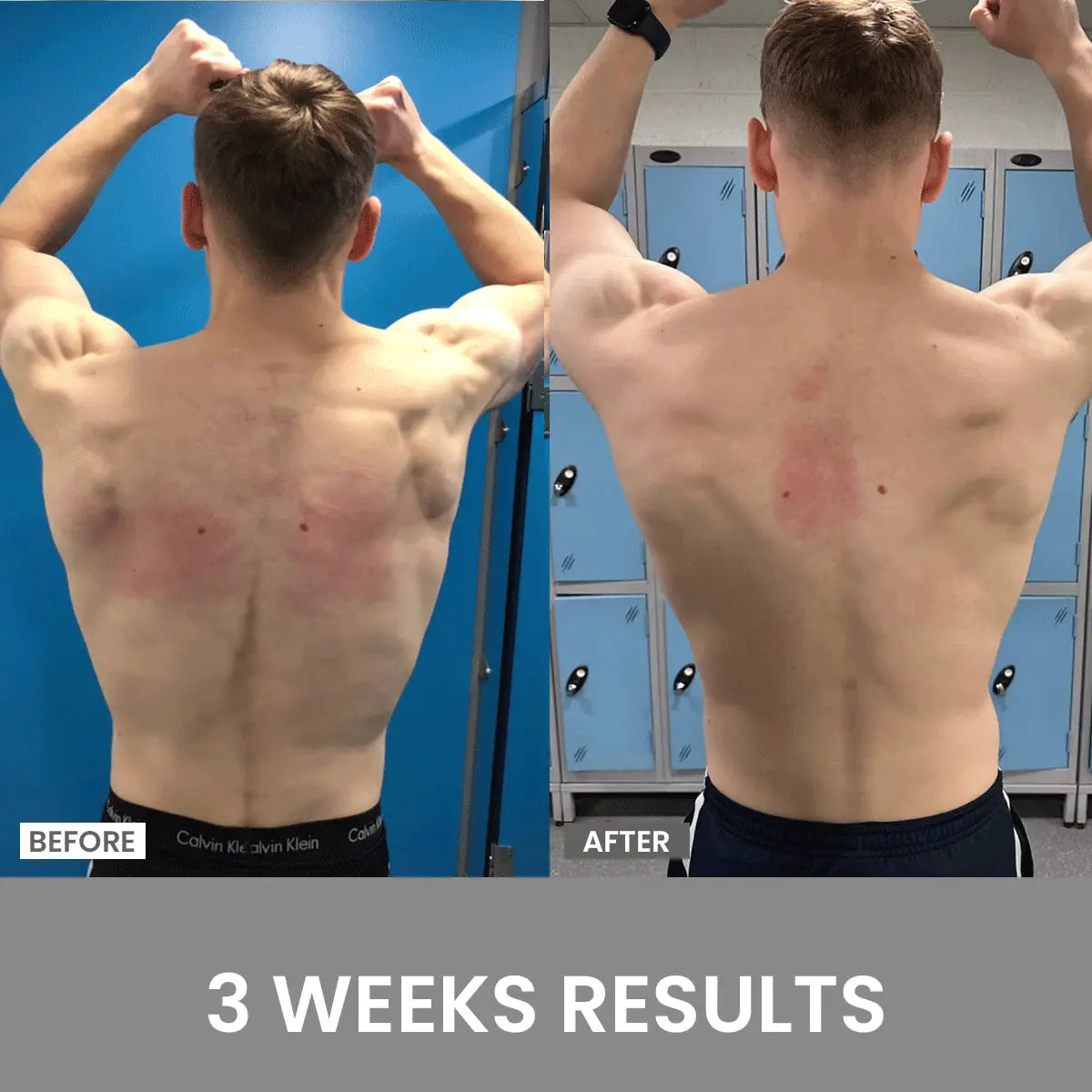 Posture Fixer – Straighten Up in a Jiffy! (Grab One, Get One Free!)